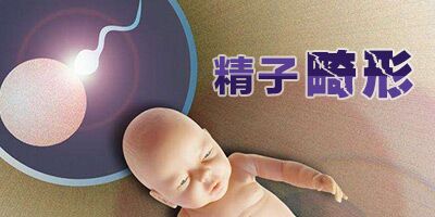 精子畸形治疗